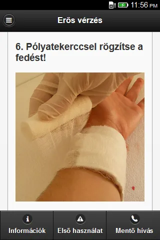 First aid steps for severe bleeding